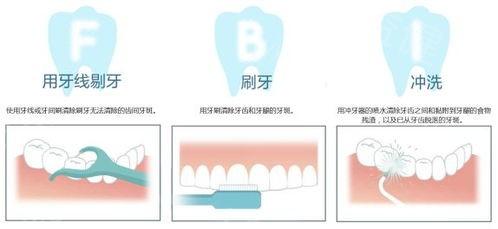 补牙可以用门诊统筹吗